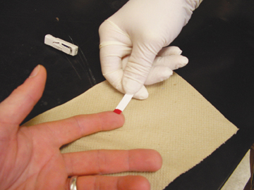 fingertip prick blood sampling on chromotography p